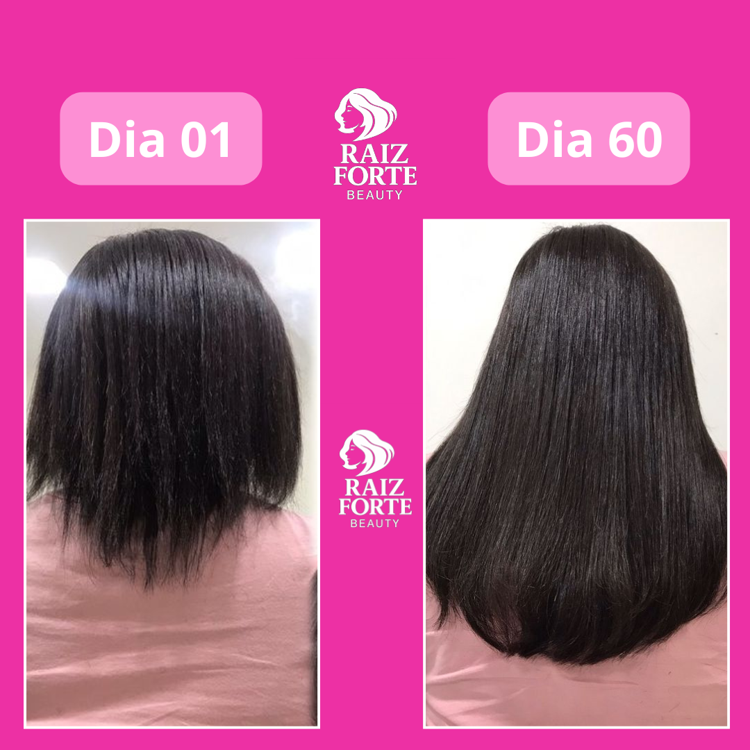 Ana Paula antes e depois Raiz Forte