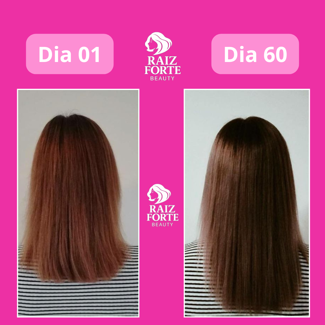 Carla antes e depois Raiz Forte