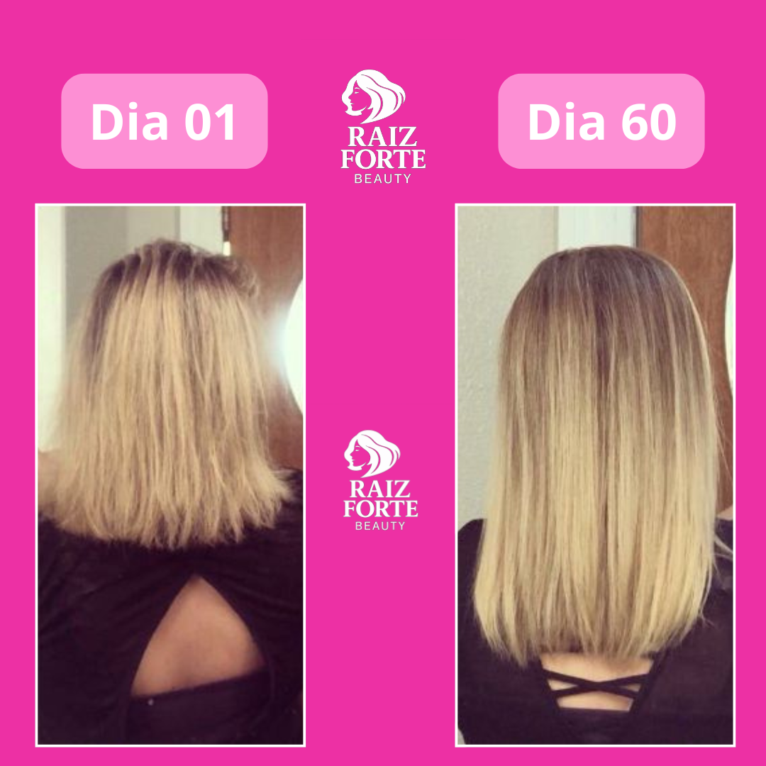 Juliana antes e depois Raiz Forte